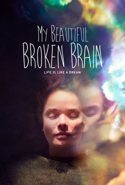 watch My Beautiful Broken Brain online free